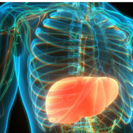 Gordura no fígado grau 3: Saiba o que é, sintomas e tratamento