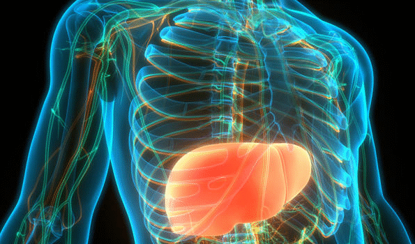 Gordura no fígado grau 3: Saiba o que é, sintomas e tratamento Gordura no fígado grau 3: Saiba o que é, sintomas e tratamento