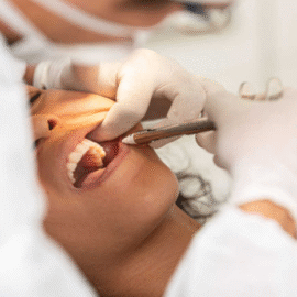 Casos de morte após extração de sisos geram investigação e mobilização Casos de morte após extração de sisos geram investigação e mobilização