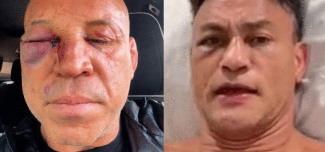 Popó passa por cirurgia e Wanderlei Silva faz novos exames após pancadaria no ringue Popó passa por cirurgia e Wanderlei Silva faz novos exames após pancadaria no ringue
